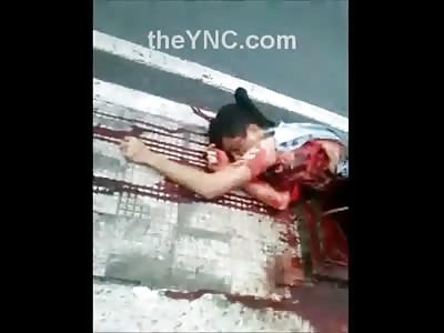 The Absolutely HORRIFIC aftermath of Riders Collision with a Pole