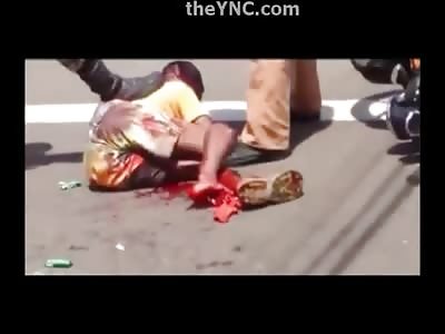 Man who Robbed a Bakery was Chased and Ran Over by the Owner of the Store..Now he is Missing a Foot 