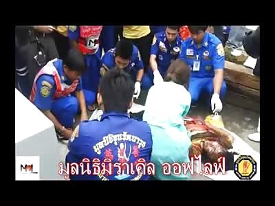 The Remains of a Woman Ran over by a Train... Breast Exsposed