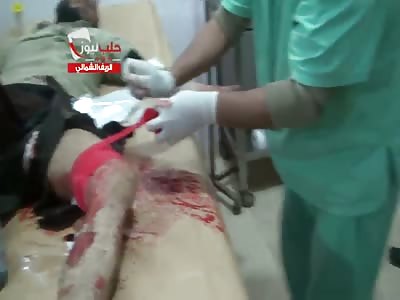 fucking humans..(skip to :20, Video is Graphic) 