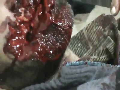 OMG !!! That's Gonna Leave A Scar