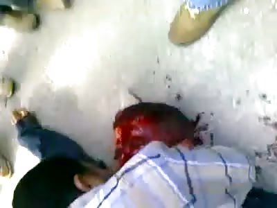 Guy Shot in The Head Is Painting The Road Red with His Blood as Crowd Carries Him