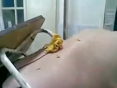 Take A Seat: The Russian Way. Man Impaled By Stool As You Can See it Poking On the Other Side Of His Body. 