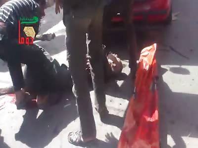 Man With Severe Trauma To His Leg