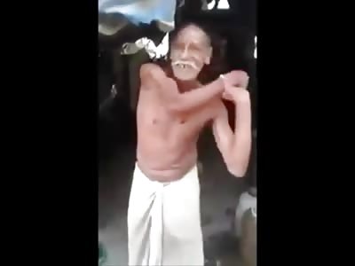 Can you Bite Your Elbow?