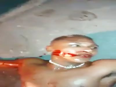 result of an exchange of gunfire with police