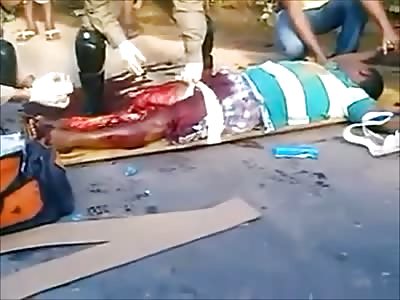 Man with his leg ripped apart after accident.