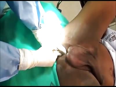  Shampoo bottle being removed from man's asshole