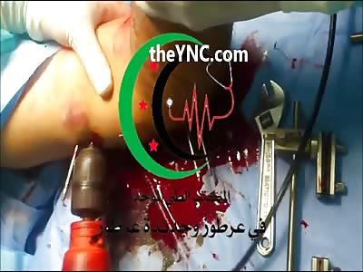 Hey Man be Calm, We'll Fix Your Arm ... Let me Get the Power Drill and Tools