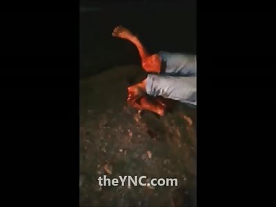 Man with severe leg injury after motorcycle accident