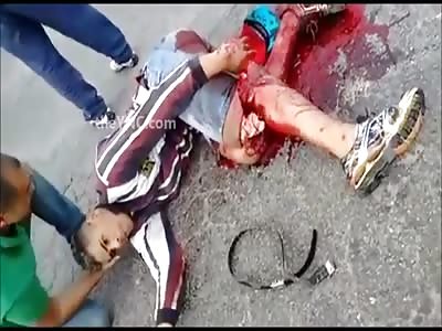 Guy With Leg Almost Ripped Off Calmly Waits for Help While Texting 