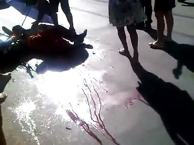 Rider with his mangled leg in pain after being hit by car