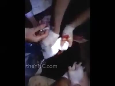 Trying to save a man who was shot in the head ... blood pouring from the mouth and nose