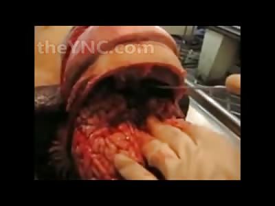 FULL Autopsy of a elderly man.