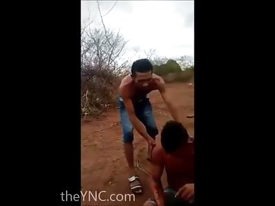 Weapon Malfunction Causes Wound to the Face of a Man