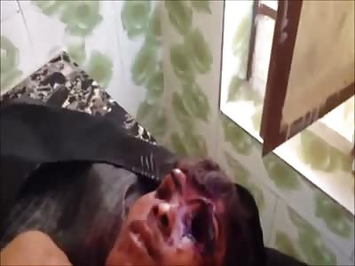 Young Man Shot in the Eye and Chest... in the morgue