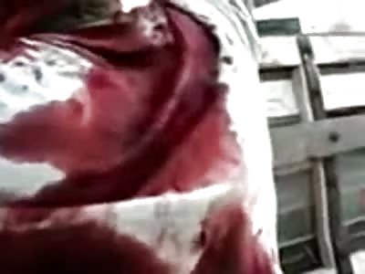  Dying Man After  Brutal  Machete Attack to his Head (*Strong Scenes*)