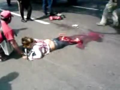 Woman Loses Both Legs in Traffic Accident