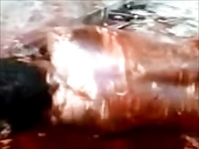 Machete Attack (aftermath)