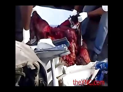 Mangled guy removed from car wreck