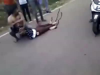 Guy Screaming in Pain After Bike Accident 