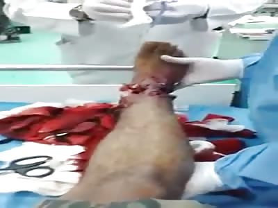 Man with a Compound Ankle Fracture is still Smiling Away 