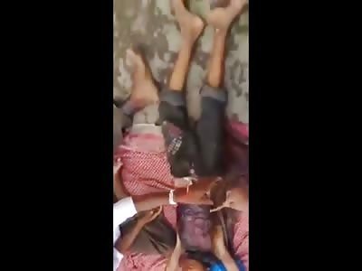 BUSTED...Street Begger Exposing Fake Burnt Skin..and Using his Child too 