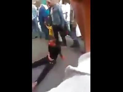 Man cant Open his Eyes after a Beating 