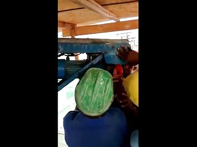 Dont Look!  Man has his Arm all Hemmed Up in a Machine at Work 