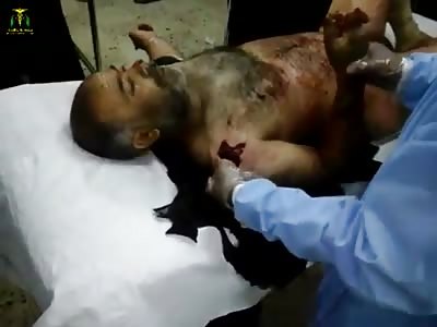 Doctor puts his Fingers inside Man's Shoulder