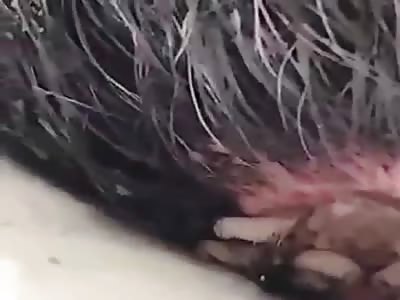 Ugh Maggot Infested Eyes and Scalp