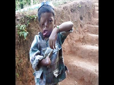 Badger's Blood letting Pt5