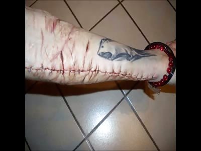 The original Emo Cutter girl photoset in full.