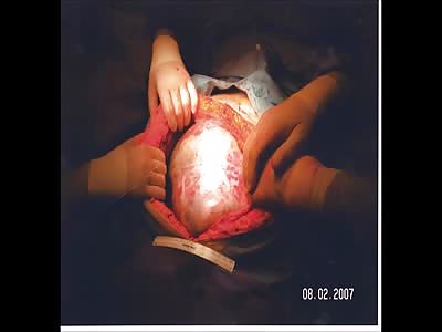 Badger's blood letting Pt4