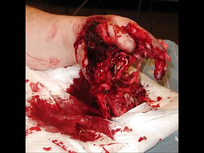 Badger's blood letting pt 7.