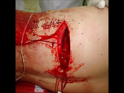 Badger's blood letting Pt6