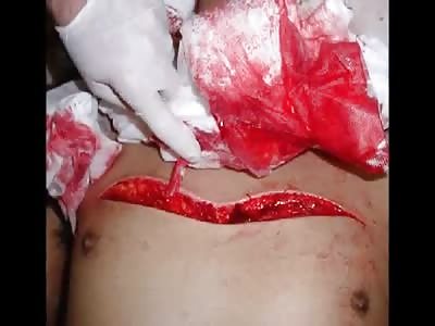 Badger's Blood Letting Pt8