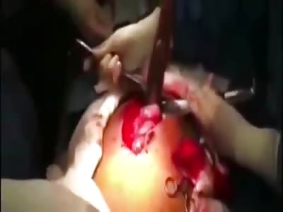 The down side of Extreme Sushi eating.