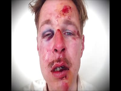 Beaten like a ginger step child.