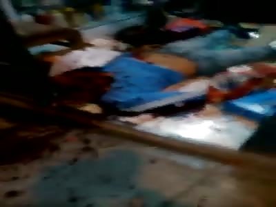 Man exploded his head with DYNAMITE