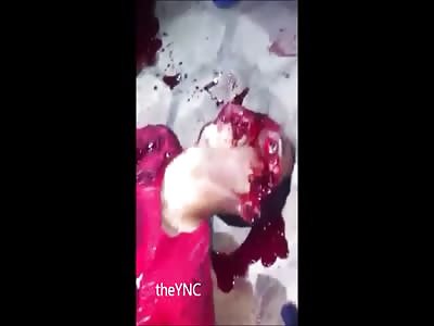 Last breath of man shot in the head with a shotgun (Better Quality) 