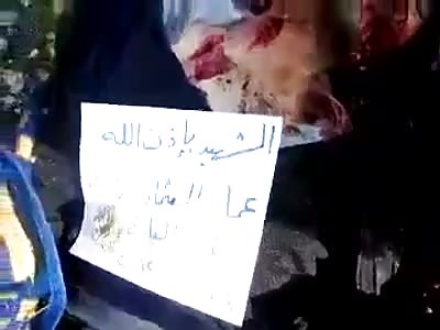 GORE - Up Close Video of Multiple Men with Gaping Holes in Their Skulls