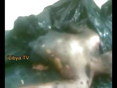 Hit by Airstrike - Man has His Lower Section Blown Off to a Crisp