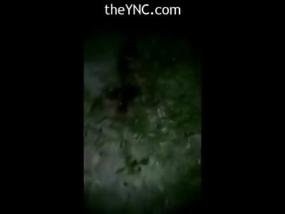 Kid in Total Agony with His Leg Ripped OFf