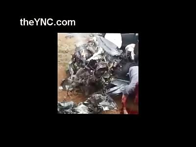 Horrific Accident Aftermath ... Mans Face Crush, Stretched and Obliterated 