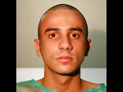 Brazilian Man Got a Dog Face by Plastic Surgery