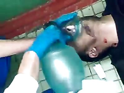 Overdose of a drug addict. Reanimation