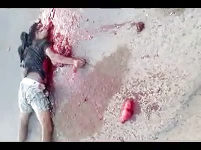 very graphic. accident a boy's hearth still beats.