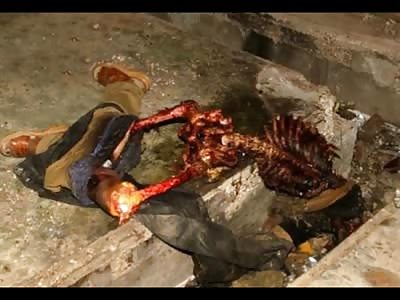 Pictures Of People Dead - or Dying