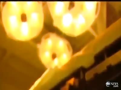 Man Lost His Face in Electrocution Accident